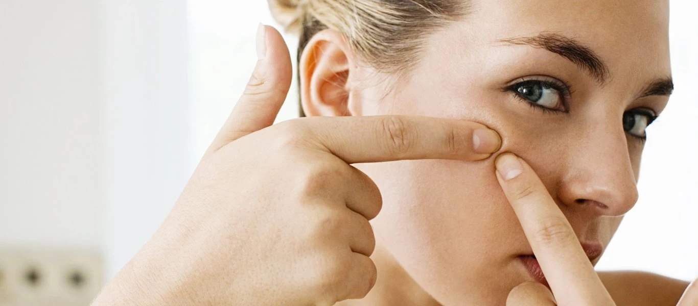 Αυτές είναι οι τροφές προκαλούν έξαρση στην ακμή